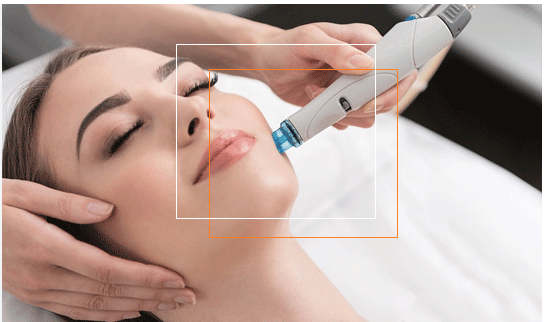 زیبایی میکرو سوزن